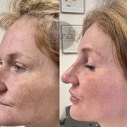 FOREVER YOUNG SOLUTIONS