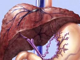 hepatic portal vein คือ pictures
