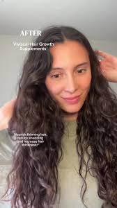 We love our 2-a-days✨ visit Viviscal.com to shop all products! #Viviscal  #Hairgrowth #hairlosssolutions