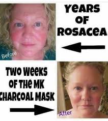 Carbonated clay face masks for detoxifying skin