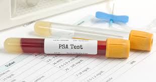 His psa was over 280 upon diagnosis. What S New About Prostate Cancer Screening Guidelines Ctca