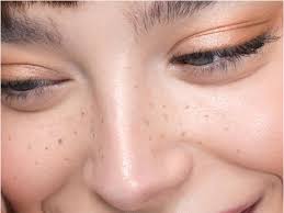 Calling Out All Freckle Fans This Is The New Faux Freckle Trend Taking Over The Internet And It S Natural Pinkvilla