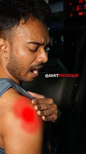 Still have my forearm injury I post that cause all beginers will fall at  this mistake always remember to warm-up and do stretching after your  workout cause my injury came from advanced