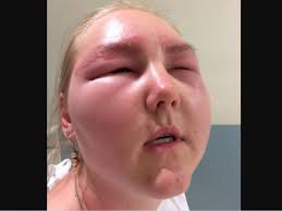 Tienen entre 9 y 12 años, descubrieron una sustancia que se vuelve tóxica y  la NASA los incorporó