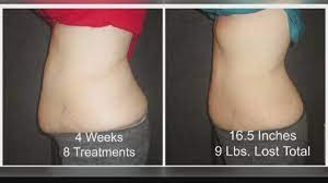Lose Inches On Your Waist In Minutes With The Help Of I-Lipo (Fcl April  8Th) | Firstcoastnews.com