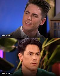 Vanderpump Rules Cast and Plastic Surgery
