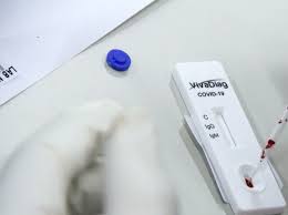 Hal Hal Yang Perlu Sobat Ketahui Tentang Rapid Test Corona Prosehat