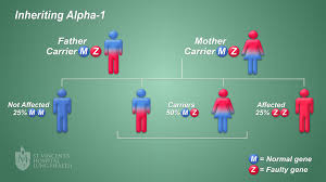 It is not possible to prevent a1ad, as it is an inherited disease. Alpha 1 Antitrypsin Deficiency St Vincent S Lung Health
