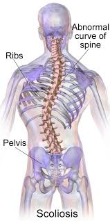 Maybe you would like to learn more about one of these? Yoga For Scoliosis Can It Help Man Flow Yoga