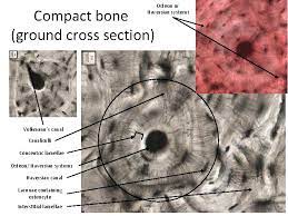 The large dark spots are passages for blood vessels and nerves. Medical School Histology Images Of Compact Bone Dr