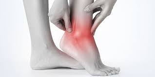 Nyeri pada pangkal ibu jari dan pergelangan tangan. 6 Ciri Ciri Asam Urat Dan Penyebab Yang Mendasarinya Ganggu Tidur Berkualitas Merdeka Com