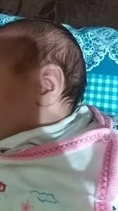 bebeklerde boyun pisigine ne iyi gelir sorcev