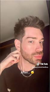 Plastic Botched Boy' removing $100K of plastic surgery: 'I've lost my  identity'