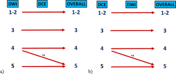 Like other types of cancer, prostate cancer is class. Prostate Magnetic Resonance Imaging For Local Recurrence Reporting Pi Rr International Consensus Based Guidelines On Multiparametric Magnetic Resonance Imaging For Prostate Cancer Recurrence After Radiation Therapy And Radical Prostatectomy