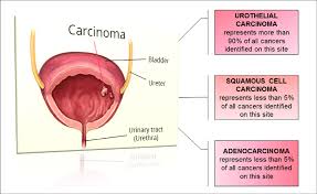 Many people wear their cancer colors proudly, but others fear the many colors green stands for liver cancer, lymphoma, and gall bladder cancer. Histological Types Of Bladder Cancer Download Scientific Diagram