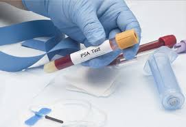 For men under age 45, no routine psa screening is needed.; Should I Be Screened Prostate Cancer Foundation