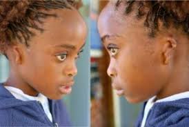 Breaking New Ground in Hearing Care: Zambia's First Bone Anchored Hearing  Implant Surgery