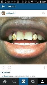Four types of alloys are defined in en iso 1562 and 8891 respectively, covering a wide range of uses in conservative and restorative dentistry and orthodontics. 27 My Type Of Grillz Ideas Grillz Gold Teeth Grills Teeth
