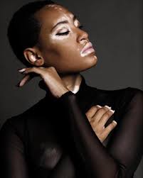 This Beautiful Young Lady Was Just Named As The First Covergirl Model With Vitiligo Can I Just Tell You That I Screamed Vitiligo Model Vitiligo Skin Vitiligo