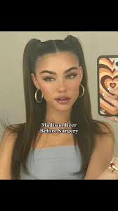 #fyp #fypシ #foryou #foryoupage #madisonbeer #surgery