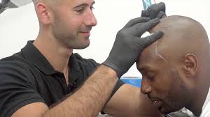 I got a man weave to impress my girlfriend. Tattoos To Bring Men Back From Baldness Rtm Rightthisminute