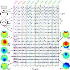 Maybe you would like to learn more about one of these? Ica Example