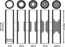 The internal carotid artery will connect to the posterior communicating artery before bifurcating into the anterior cerebral artery (aca) and the. Near Real Time Magnetic Particle Imaging For Visual Assessment Of Vascular Stenosis In A Phantom Model Physica Medica European Journal Of Medical Physics