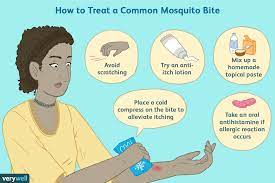 How to soothe mosquito bites? Mosquito Bite Treatment For Itching And How To Recognize Infections