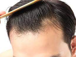 What is a short haircut? Thicken Your Hair 11 Clever Hair Thickening Tips