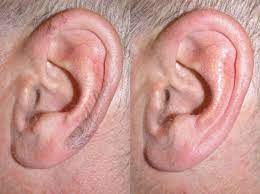 Ear hair removal creams and depilatories. Ear Hair Function Ear Hair Removal Techniques