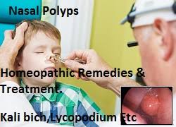 Homeopathy believes in treating the patient and not just the disease. Homeopathic Remedy For Nasal Polyps Natural Removal Without Surgery