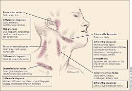 Lymphadenopathy And Malignancy December 1 2002 American Family Physician Very Interesting Lymph Nodes Lymph Drainage Skin Neoplasm