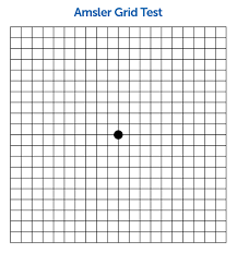 amsler grid test