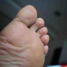 Yang mulia gurubesar tapak wali indonesia lahir di lapajung pada tanggal 11 november 1962 di kab. Tumit Kaki Pecah Camana Nak Travel Camni Ben Ashaari