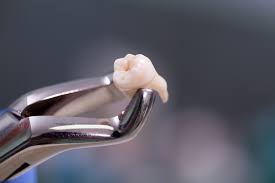 Trying to pull a broken tooth at home is especially dangerous if you don't have the proper tools. Self Tooth Extraction Can You Pull Your Own Tooth 1dental