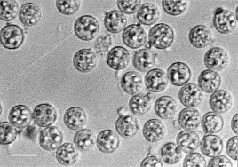 Image result for Cyclospora