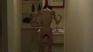 Anorexic asian