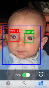 Children often get sick or have bumps or bruises that might mask the early signs of cancer. New App Scours Baby Pictures For Eye Health Risks Mobihealthnews