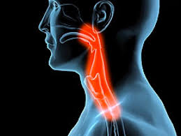 Lendir di tekak biasanya dirawat dengan pengambilan antihistamine, decongestant dan dalam kes yang teruk, mungkin steroids. Cara Terbaik Sembuh Gastrik Gerd Angin