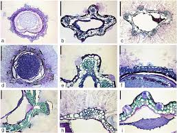 Image result for Pentzia