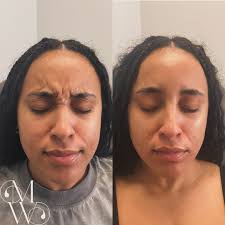 Monique Whitehurst-FNP, Aesthetic Injector/Trainer💉  (@nurseinjectormo__fnp) • Instagram photos and videos