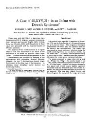 Many affected infants also have unusually flat midfacial regions (midfacial hypoplasia), including a short nose, flattened nasal bridge, and upturned nostrils (anteverted nares); A Case Of 48 Xxy 21 In An Infant With Down S Syndrome Journal Of Medical Genetics