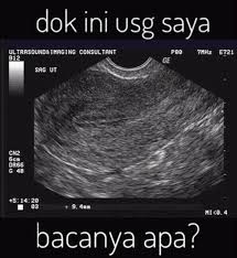 Islami, jawa, modern, kristen nama bayi perempuan islam huruf a. Cara Membaca Hasil Foto Suaraperawat Com ð— ð—²ð—±ð—¶ð—®ð—¡ð—®ð—¸ð—²ð˜€ Facebook