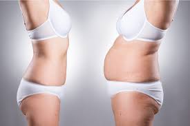 Image result for Liposuction