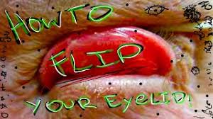 600 x 449 jpeg 27 кб. How To Evert Eyelid Herunterladen