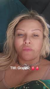 Tiffany Elizabeth Tummy Tuck