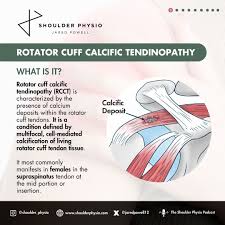 Image result for Rotator Cuff Calcification
