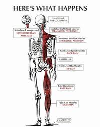 Rotation and lateral flexion of the head are accomplished by lateral and posterior neck muscles. Body Imbalance Skeletal Dr Ashley Thompson Facebook