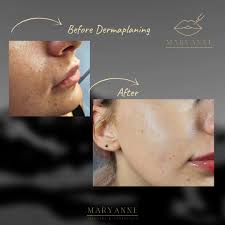 Maryanne Skincare and Aesthetics