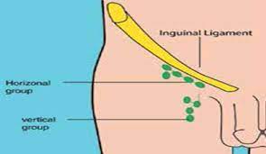 How To Check Your Lymph Nodes - Northern Health And Social Care Trust